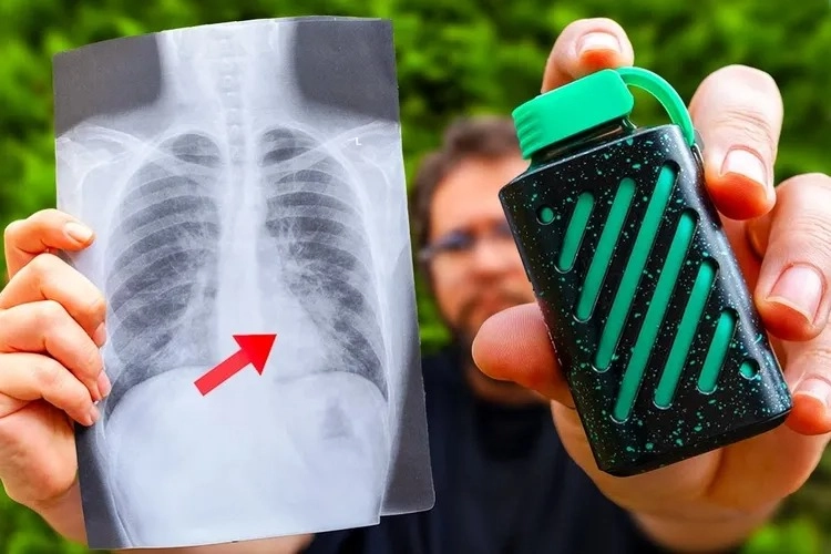 E Sigaralar Uzun Vadede Kalıcı Hasar Oluşturabilir!