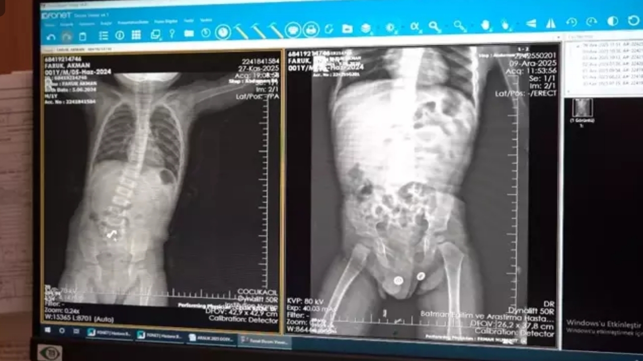 Batman Egitim Arastirmada Kritik (1)