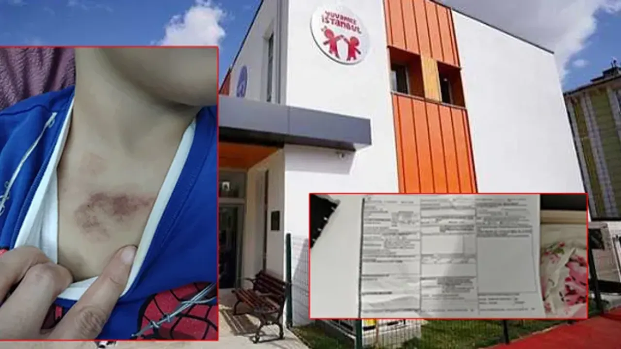 Hani Cocuklar Size Emanetti Ibb Kresindeki Skandalda Ilk Tutuklama Geldi2