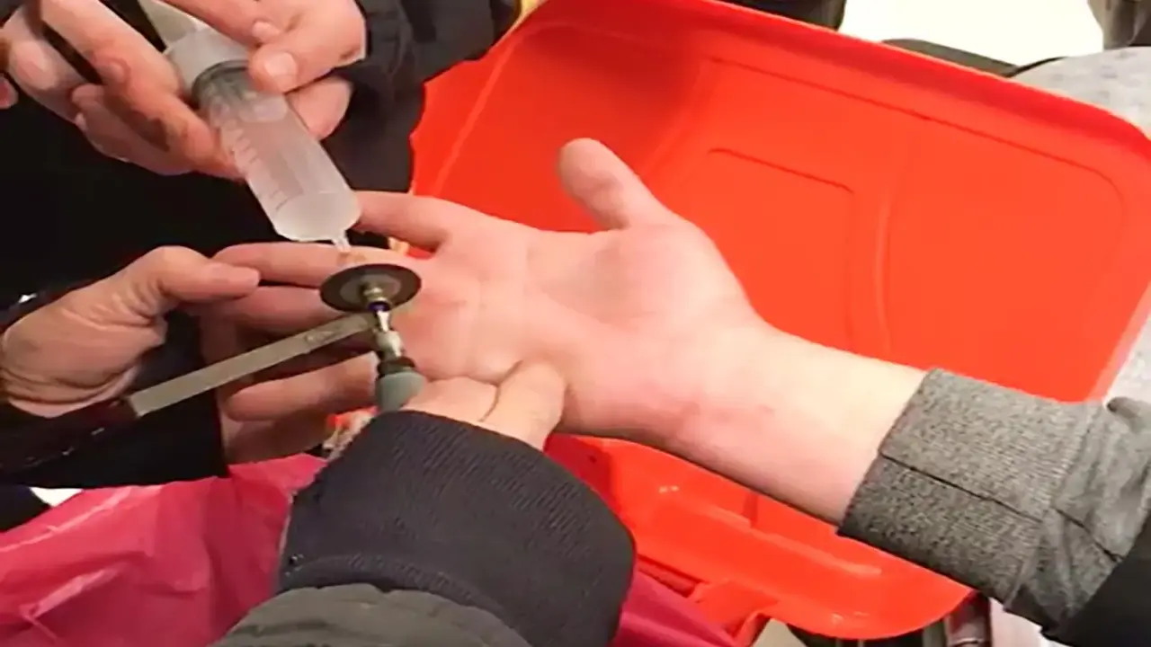 Parmağına Yüzük Sıkıştı, İtfaiye Kurtardı