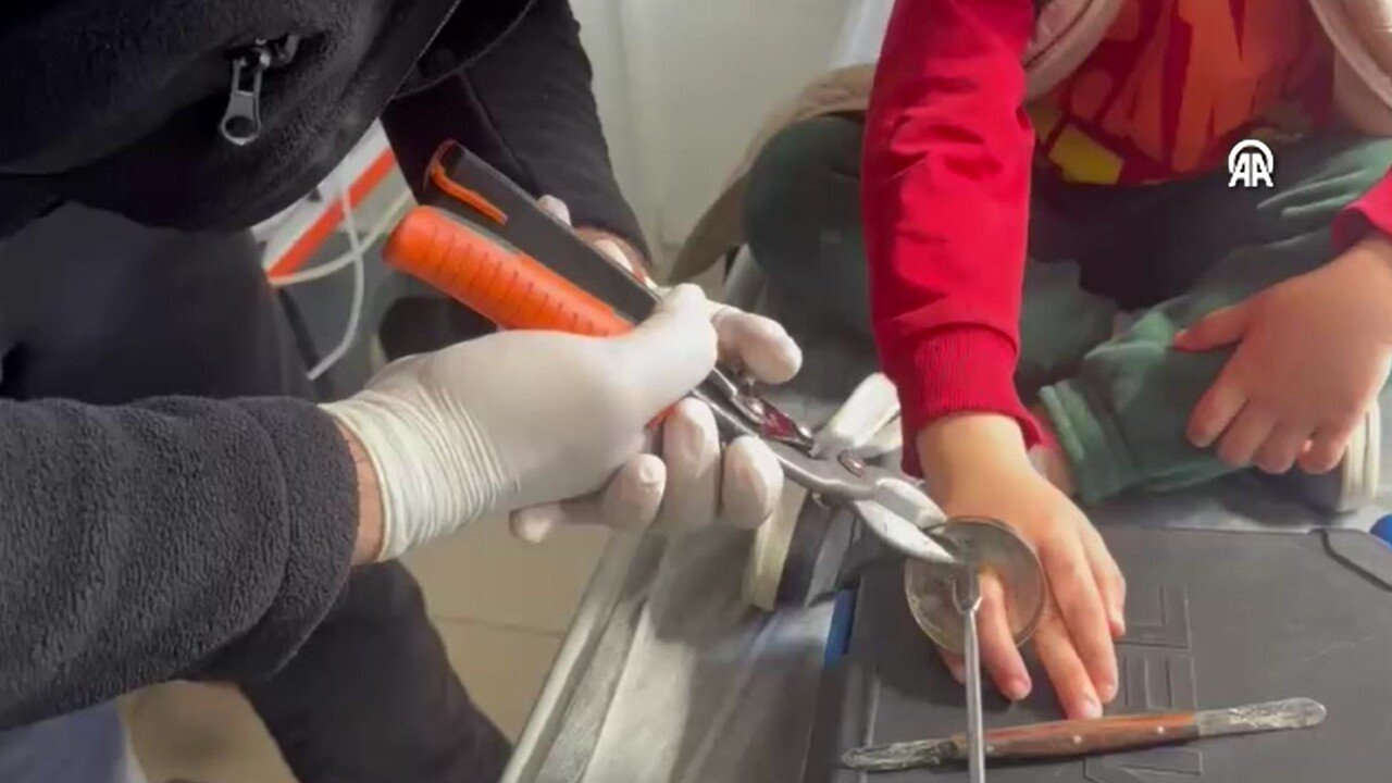 Batmanlı Çocuğun Parmağına Sıkışan Halka Kesilerek Çıkarıldı