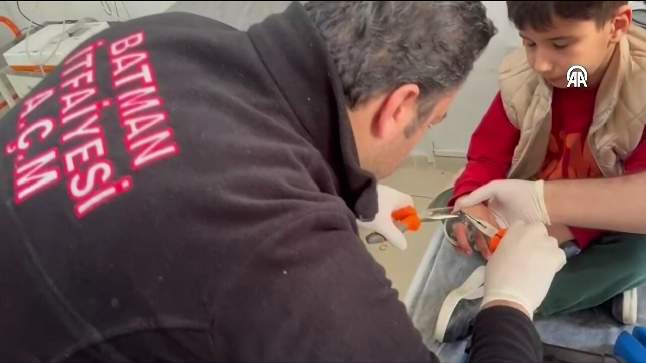 Batmanli Cocugun Parmagina Sikisan Halka Kesilerek Cikarildi 2