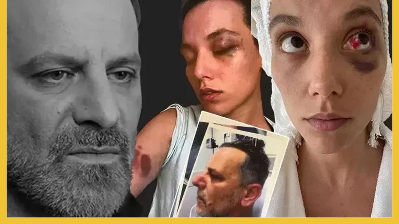 Ozan Güven'e 'Silahla Kasten Yaralama'dan Hapis Cezası