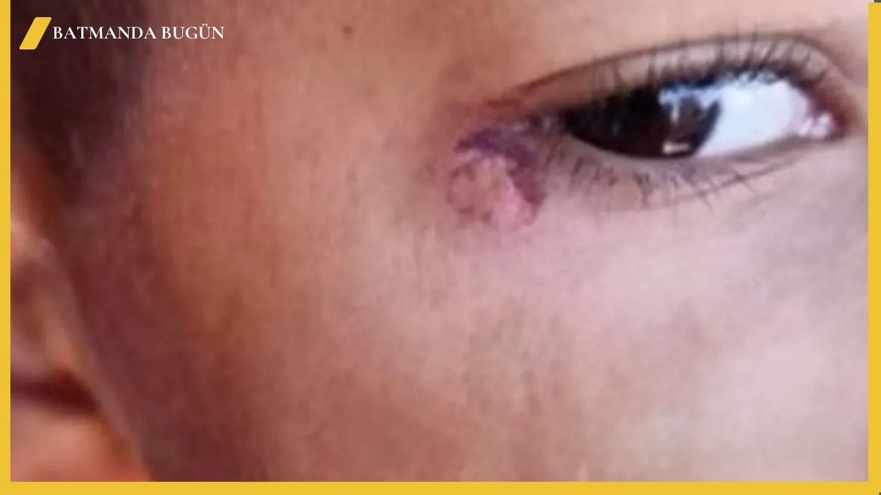 Şanlıurfa'da Temizlik Görevlisinden Öğrenciye İçler Acısı Saldırı