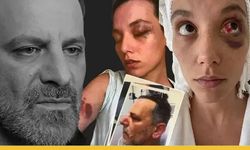 Ozan Güven'e 'Silahla Kasten Yaralama'dan Hapis Cezası