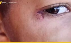 Şanlıurfa'da Temizlik Görevlisinden Öğrenciye İçler Acısı Saldırı