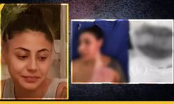 İstanbul’un Göbeğinde Kıskançlık Kurbanı Bir Kadın Yakılarak Ağır Yaralandı