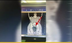 Batman’da "X-Ray" Radarına Takılan Kaçakçı: Midesinden Zehir Çıktı