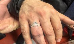 Batman İtfaiyesi Sıkışan Yüzüğü Keserek Çıkardı