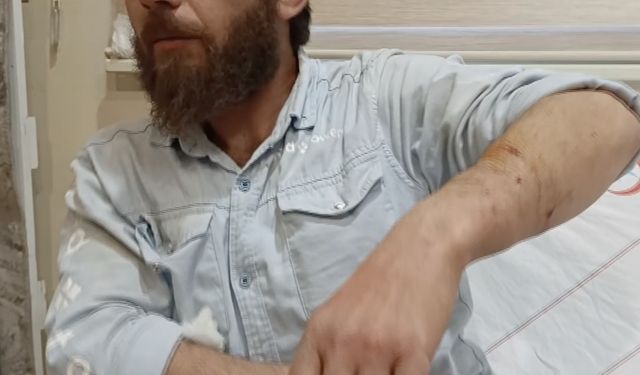 Adıyaman'da sahipli köpeğin saldırdığı yabancı uyruklu kişi yaralandı