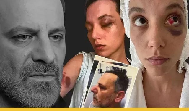 Ozan Güven'e 'Silahla Kasten Yaralama'dan Hapis Cezası