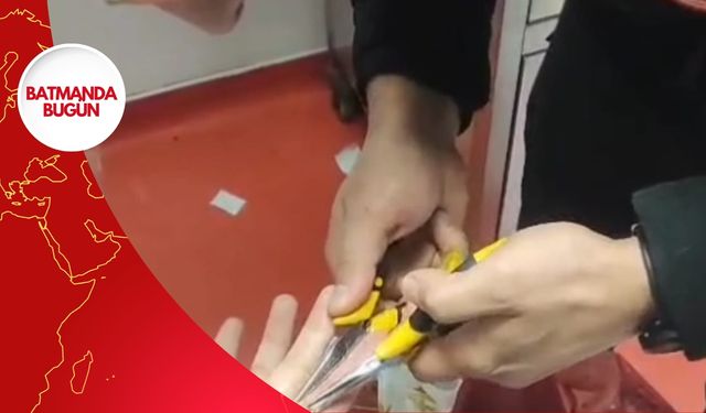 Batman'da Sıkışan Yüzük İçin İtfaiye Yetişti