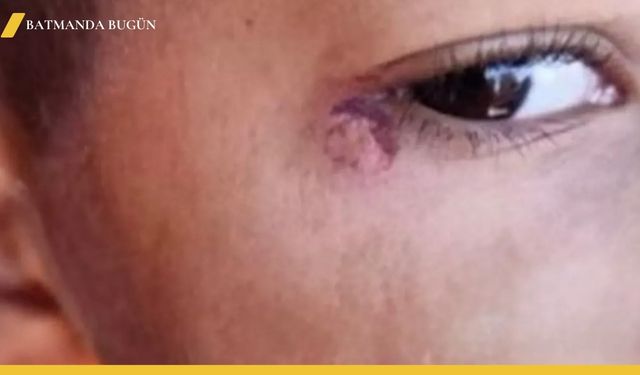 Şanlıurfa'da Temizlik Görevlisinden Öğrenciye İçler Acısı Saldırı