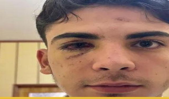 Konya’daki Muştalı Saldırıda Adalet Freni: Kanlı Ellerle Yapılan Sosyal Medya Şovu Yarım Kaldı