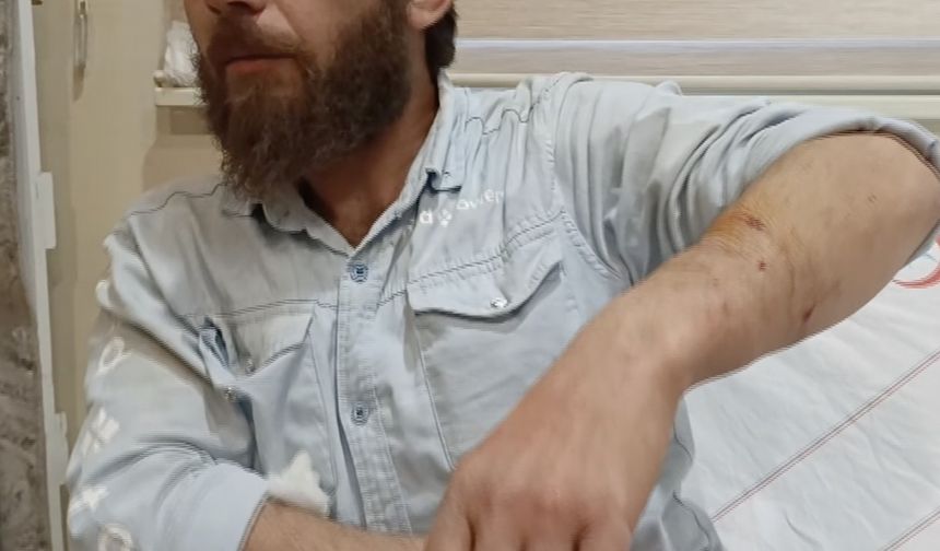 Adıyaman'da sahipli köpeğin saldırdığı yabancı uyruklu kişi yaralandı