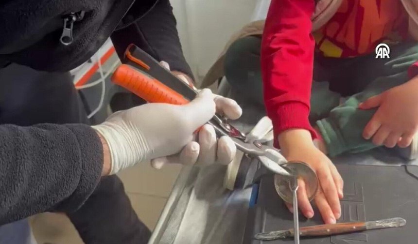 Batmanlı Çocuğun Parmağına Sıkışan Halka Kesilerek Çıkarıldı